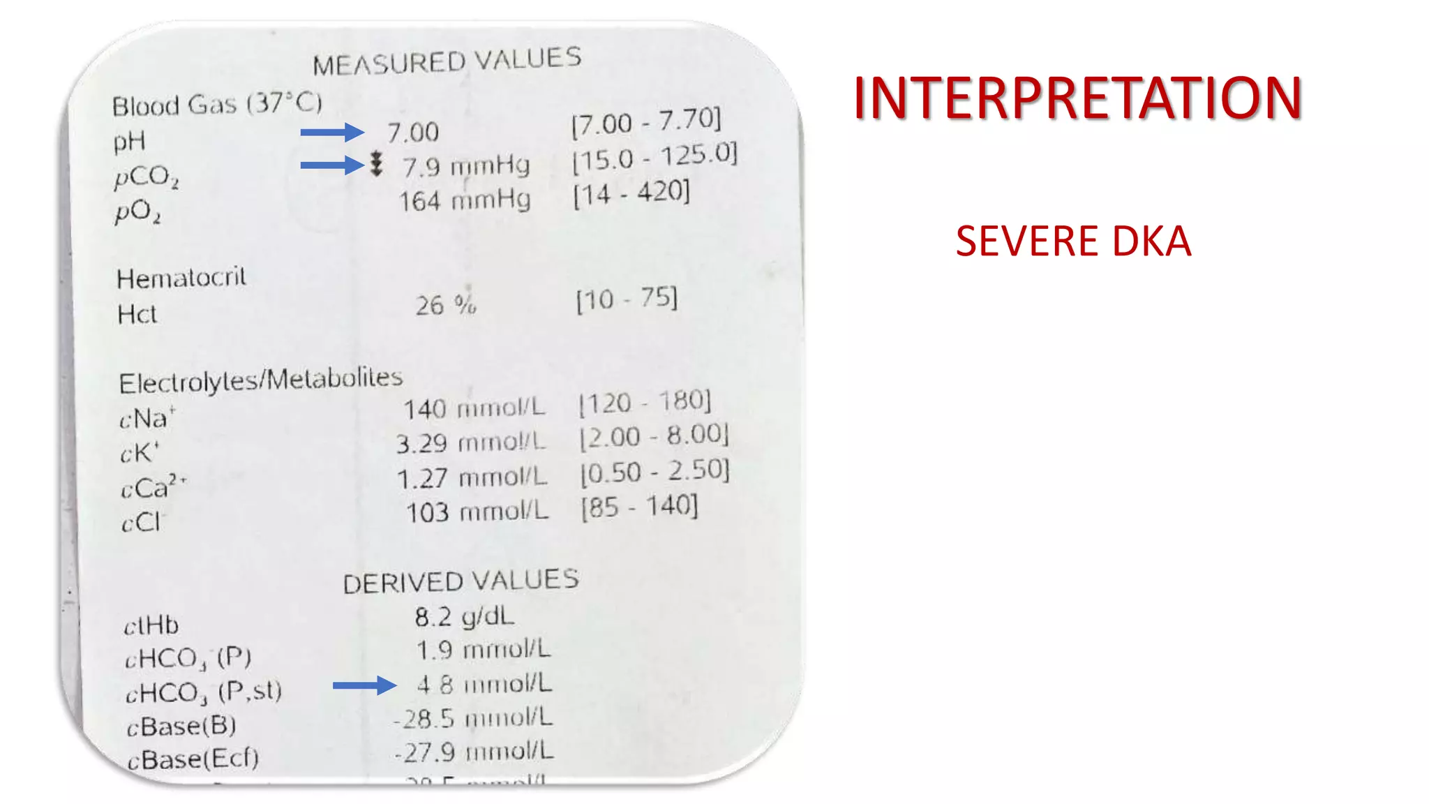 DIABETIC KETOACIDOSIS IN CHILDREN by Dr.Gobinda | PPTX