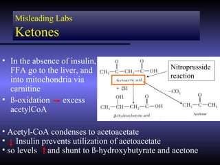 Misleading Labs
   Ketones

• In the absence of insulin,
  FFA go to the liver, and                    Nitroprusside
                                              reaction
  into mitochondria via
  carnitine
• ß-oxidation excess
  acetylCoA

• Acetyl-CoA condenses to acetoacetate
• Insulin prevents utilization of acetoacetate
• so levels and shunt to ß-hydroxybutyrate and acetone
 