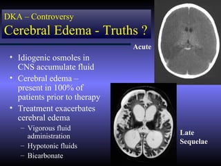 DKA – Controversy
Cerebral Edema - Truths ?
                               Acute
 • Idiogenic osmoles in
   CNS accumulate fluid
 • Cerebral edema –
   present in 100% of
   patients prior to therapy
 • Treatment exacerbates
   cerebral edema
    – Vigorous fluid
      administration                   Late
                                       Sequelae
    – Hypotonic fluids
    – Bicarbonate
 