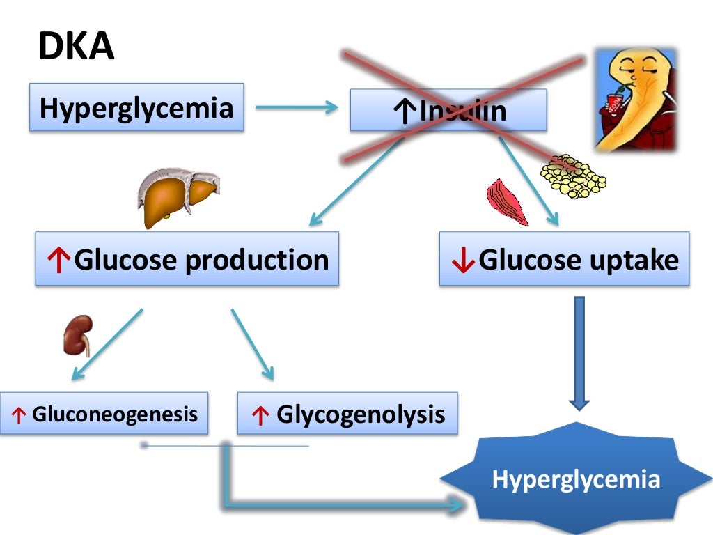 DKA pathophysiology