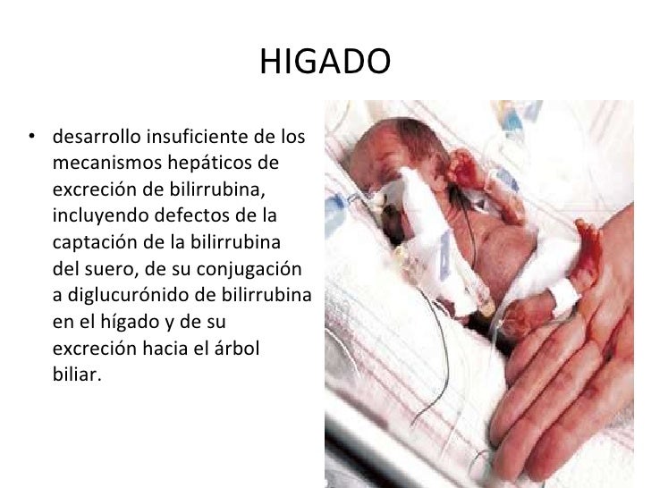 Recien nacido prematuro