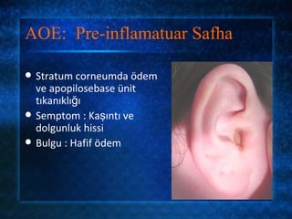 AOE: Pre-inflamatuar Safha

   Stratum corneumda ödem
    ve apopilosebase ünit
    tıkanıklığı
   Semptom : Kaşıntı ve
    dolgunluk hissi
   Bulgu : Hafif ödem
 