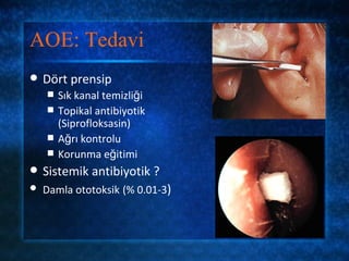 AOE: Tedavi
   Dört prensip
       Sık kanal temizliği
       Topikal antibiyotik
        (Siprofloksasin)
       Ağrı kontrolu
       Korunma eğitimi
   Sistemik antibiyotik ?
   Damla ototoksik (% 0.01-3)
 