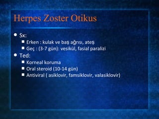 Herpes Zoster Otikus
   Sx:
       Erken : kulak ve baş ağrısı, ateş
       Geç : (3-7 gün): vesikül, fasial paralizi
   Ted:
       Korneal koruma
       Oral steroid (10-14 gün)
       Antiviral ( asiklovir, famsiklovir, valasiklovir)
 