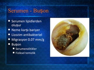 Serumen - Buşon
   Serumen lipidlerden
    oluşur
   Neme karşı bariyer
   Lizozim antibakteriel
   Migrasyon 0.07 mm/g
   Buşon
       Serumenolitikler
       Fiziksel temizlik
 