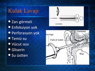 Kulak Lavajı
 Zarı görmeli
 Enfeksiyon yok
 Perforasyon yok
 Temiz su
 Vücut ısısı
 Gliserin
 Su üstten
 
