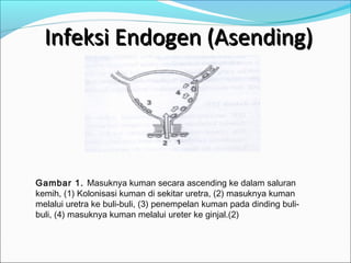 Infeksi Endogen (Asending)




Gambar 1. Masuknya kuman secara ascending ke dalam saluran
kemih, (1) Kolonisasi kuman di sekitar uretra, (2) masuknya kuman
melalui uretra ke buli-buli, (3) penempelan kuman pada dinding buli-
buli, (4) masuknya kuman melalui ureter ke ginjal.(2)
 