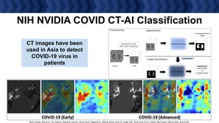 NIH NVIDIA COVID CT-AI Classification
Segmentation
Image Classification
Preprocessing
Conversion to nifti
with 1x1x1 resampling
dicoms nifti
AH-Net Architecture
3D-Densnet-121
Apply Mask
Classification
Likely COVID
Vs
Unlikely COVID
Lung Segmentation
Mask
Baris Turkbey, Sheng Xu, Tom Sanford, Stephanie Harmon,, Mona Flores, Daguang Xu, Xiasong Wang, Ziyue Xu, Holger Roth, Dong Yang, Evrim Turkbey, Mike Kassin, Maxime Blain, Brad Wood
CT images have been
used in Asia to detect
COVID-19 virus in
patients
 