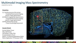 For more information, visit KPMP.org Visit KPMP.org for more information
KIDNEY PRECISION MEDICINE PROJECT
Modalities
(1) Autofluorescence Microscopy
- Unstained fluorescence imaging
used for image segmentation.
(2) MALDI Imaging Mass Spectrometry
- Unstained fluorescence imaging
used for image segmentation.
(3) PAS-Stained Microscopy
- Tissue morphology/assessment
Sample Details
Human Kidney Tissue
38 yr Old Female
Left Kidney / Lower Pole
Cryosectioned at 10 µm
Matrix: 1,5-Diaminonaphthalene (DAN)
Matrix Application: TM-Sprayer (HTX) 1 mm
Multimodal Imaging Mass Spectrometry
EXAMPLE DATA
 