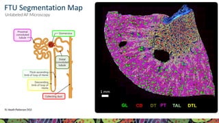 For more information, visit KPMP.org Visit KPMP.org for more information
KIDNEY PRECISION MEDICINE PROJECT
PT TAL
DT
CD DTL
GL
1 mm
N. Heath Patterson (VU)
Unlabeled AF Microscopy
FTU Segmentation Map
 