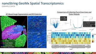 Visit KPMP.org for more information
KIDNEY PRECISION MEDICINE PROJECT
AF-Based Image Segmentation and ROI Selection
Comparison of Collecting Ducts from Inner and
Outer Medulla
nanoString GeoMx Spatial Transcriptomics
EXAMPLE DATA
 
