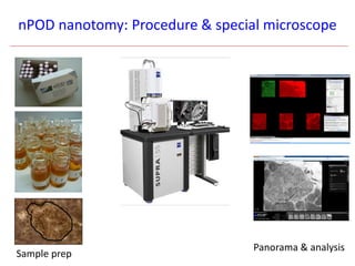 nPOD nanotomy: Procedure & special microscope
Sample prep
Panorama & analysis
 