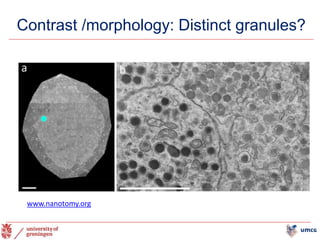 Contrast /morphology: Distinct granules?
22
www.nanotomy.org
 