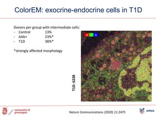 ColorEM: exocrine-endocrine cells in T1D
T1D:
6228
Nature Communications (2020) 11:2475
Donors per group with intermediate cells:
- Control 13%
- AAb+ 23%*
- T1D 38%*
*strongly affected morphology
N P S
 