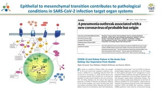 Epithelial to mesenchymal transition contributes to pathological
conditions in SARS-CoV-2 infection target organ systems
 