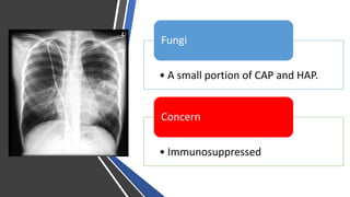 • A small portion of CAP and HAP.
Fungi
• Immunosuppressed
Concern
 