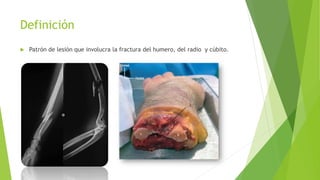 Definición
 Patrón de lesión que involucra la fractura del humero, del radio y cúbito.
 
