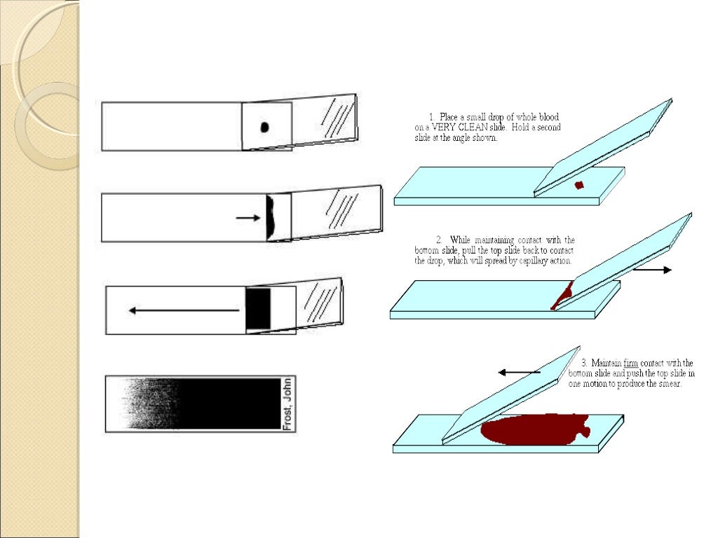Dlc by peripheral smear comparison with automated differential