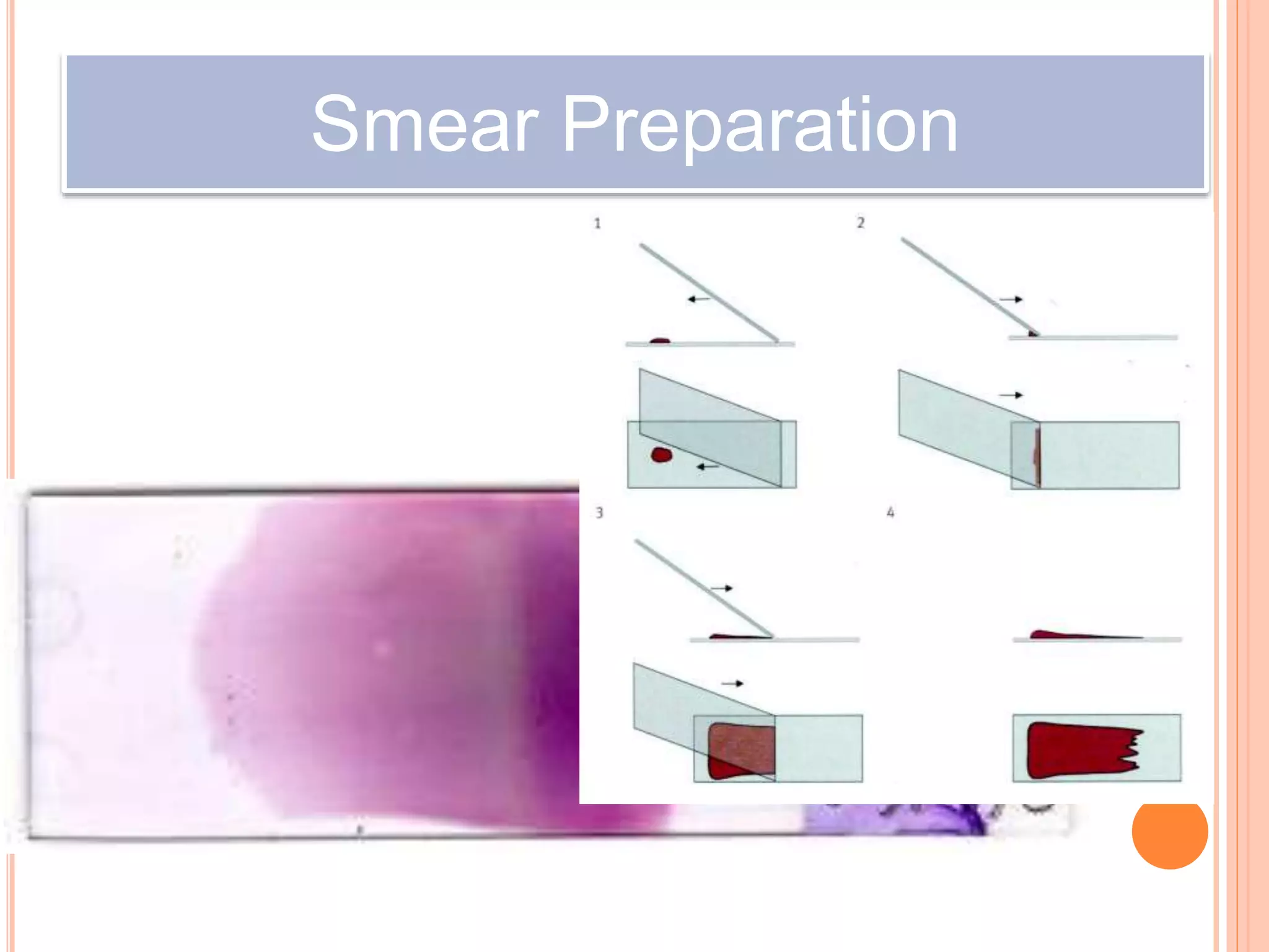 Smear Preparation
 