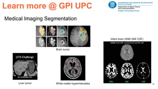 18
Medical Imaging Segmentation
Learn more @ GPI UPC
Brain tumor
Infant brain (WM/ GM/ CSF)
White matter hyperintensitiesLiver tumor
 