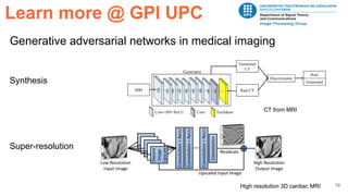 19
Generative adversarial networks in medical imaging
Synthesis
Super-resolution
Learn more @ GPI UPC
CT from MRI
High resolution 3D cardiac MRI
 