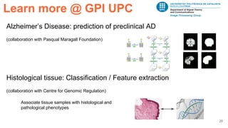 20
Alzheimer’s Disease: prediction of preclinical AD
(collaboration with Pasqual Maragall Foundation)
Histological tissue: Classification / Feature extraction
(collaboration with Centre for Genomic Regulation)
Learn more @ GPI UPC
Associate tissue samples with histological and
pathological phenotypes
 