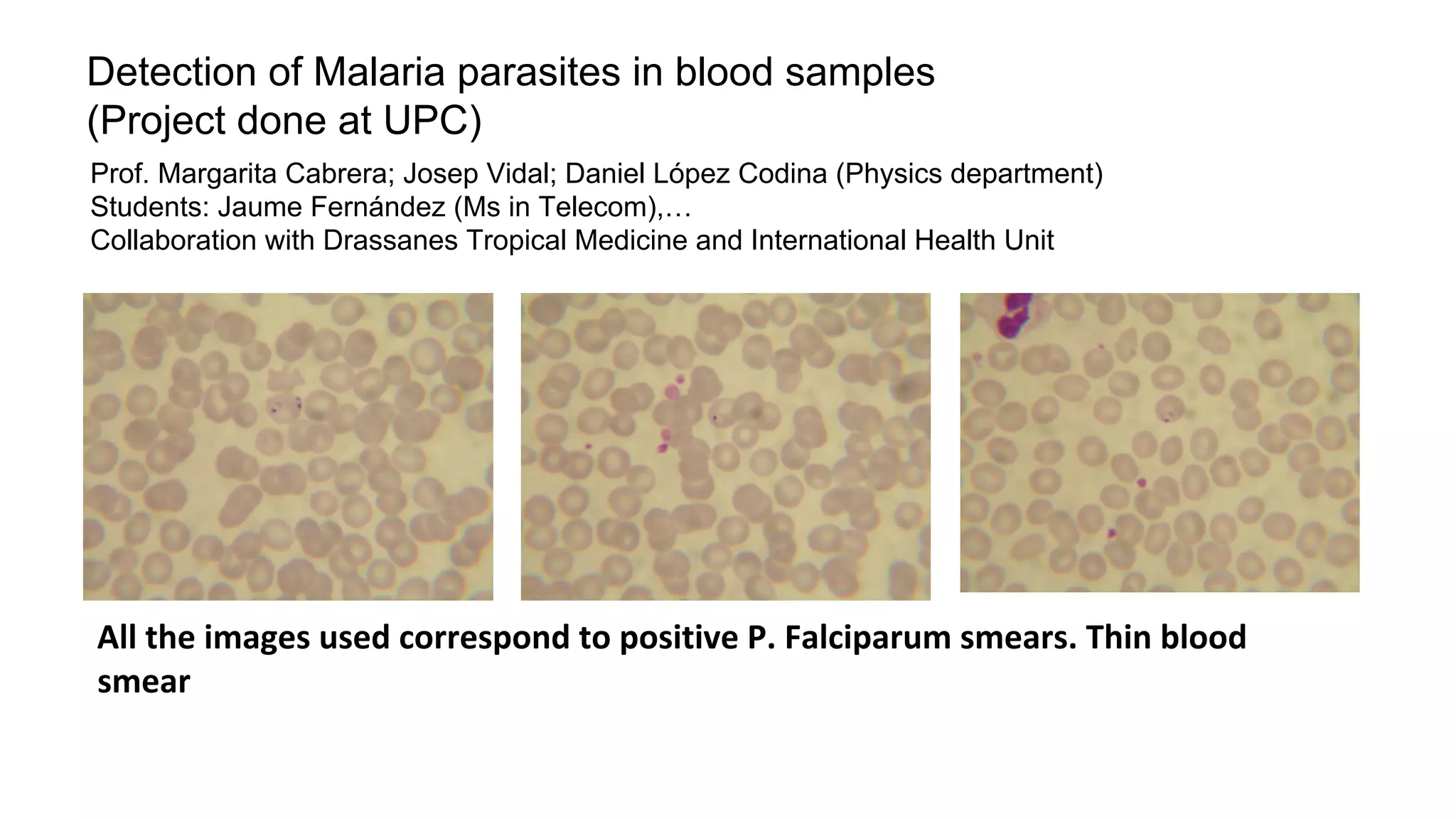 Detection of Malaria parasites in blood samples
(Project done at UPC)
Prof. Margarita Cabrera; Josep Vidal; Daniel López Codina (Physics department)
Students: Jaume Fernández (Ms in Telecom),…
Collaboration with Drassanes Tropical Medicine and International Health Unit
 