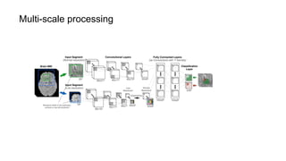 Multi-scale processing
 