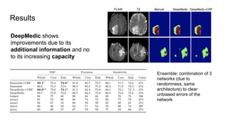 Results
DeepMedic shows
improvements due to its
additional information and no
to its increasing capacity
Ensemble: combination of 3
networks (due to
randomness, same
architecture) to clear
unbiased errors of the
network
 