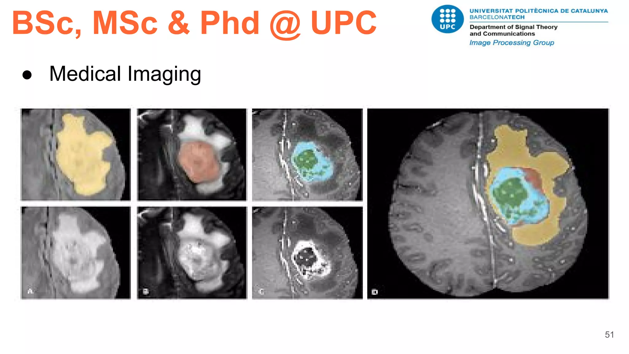 BSc, MSc & Phd @ UPC
51
● Medical Imaging
 