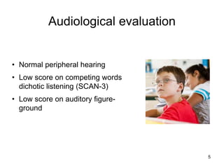 Audiological evaluation
5
• Normal peripheral hearing
• Low score on competing words
dichotic listening (SCAN-3)
• Low score on auditory figure-
ground
 