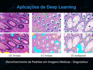Aplicações de Deep Learning
Reconhecimento de Padrões em Imagens Médicas - Diagnóstico
 