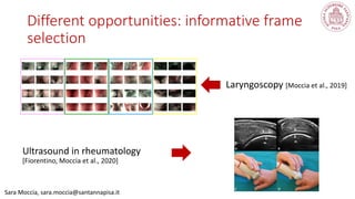 Sara Moccia, sara.moccia@santannapisa.it
Different opportunities: informative frame
selection
Laryngoscopy [Moccia et al., 2019]
Ultrasound in rheumatology
[Fiorentino, Moccia et al., 2020]
 