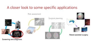 Screening and diagnosis
Surgical planning
Risk assessment
Robot-assisted surgery
A closer look to some specific applications
 