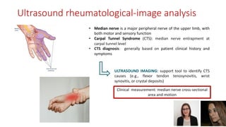 • Median nerve is a major peripheral nerve of the upper limb, with
both motor and sensory function
• Carpal Tunnel Syndrome (CTS): median nerve entrapment at
carpal tunnel level
• CTS diagnosis: generally based on patient clinical history and
symptoms
ULTRASOUND IMAGING: support tool to identify CTS
causes (e.g., flexor tendon tenosynovitis, wrist
synovitis, or crystal deposits)
Clinical measurement: median nerve cross-sectional
area and motion
Ultrasound rheumatological-image analysis
 
