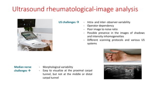 US challenges à - Intra- and inter- observer variability
- Operator dependency
- Poor image to noise ratio
- Possible presence in the images of shadows
and intensity inhomogeneities
- Different scanning protocols and various US
systems
- Morphological variability
- Easy to visualize at the proximal carpal
tunnel, but not at the middle or distal
carpal tunnel
Median nerve
challenges à
Ultrasound rheumatological-image analysis
 