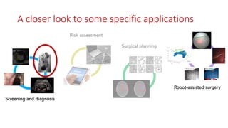 Screening and diagnosis
Surgical planning
Risk assessment
Robot-assisted surgery
A closer look to some specific applications
 