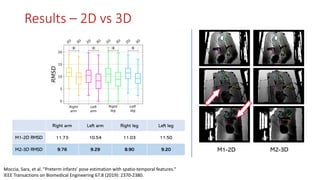 Right arm Left arm Right leg Left leg
M1-2D RMSD 11.73 10.54 11.03 11.50
M2-3D RMSD 9.76 9.29 8.90 9.20 M1-2D M2-3D
Moccia, Sara, et al. "Preterm infants’ pose estimation with spatio-temporal features."
IEEE Transactions on Biomedical Engineering 67.8 (2019): 2370-2380.
Results – 2D vs 3D
 