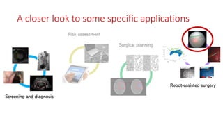 Screening and diagnosis
Surgical planning
Risk assessment
Robot-assisted surgery
A closer look to some specific applications
 