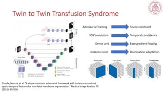 Twin to Twin Transfusion Syndrome
Adversarial Training Shape constraint
3D Convolution
Dense unit
Instance norm
Temporal consistency
Ease gradient flowing
Illumination adaptation
Casella, Moccia, et al. "A shape-constraint adversarial framework with instance-normalized
spatio-temporal features for inter-fetal membrane segmentation." Medical Image Analysis 70
(2021): 102008.
 