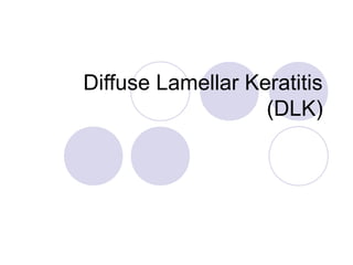 Diffuse Lamellar Keratitis
(DLK)
 