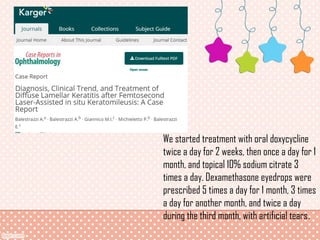 Diffuse Lamellar Keratitis (DLK) | PPT