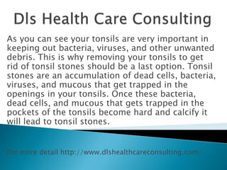 As you can see your tonsils are very important in
keeping out bacteria, viruses, and other unwanted
debris. This is why removing your tonsils to get
rid of tonsil stones should be a last option. Tonsil
stones are an accumulation of dead cells, bacteria,
viruses, and mucous that get trapped in the
openings in your tonsils. Once these bacteria,
dead cells, and mucous that gets trapped in the
pockets of the tonsils become hard and calcify it
will lead to tonsil stones.
For more detail http://www.dlshealthcareconsulting.com/
 