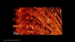 • Mouse cortex imaged with CFM
 