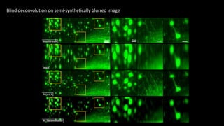 Blind deconvolution on semi-synthetically blurred image
25 μm 10 μm
 