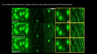Our method addresses these artifacts which are not simply corrected by PSF-deconvolution.
x
z
50 μm
10 μm
 