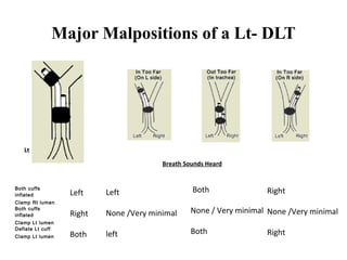 Major Malpositions of a Lt- DLT
Both cuffs
inflated
Clamp Rt lumen
Both cuffs
inflated
Clamp Lt lumen
Deflate Lt cuff
Clamp Lt lumen
Left
None /Very minimal
left
Left
Right
Both
Both
None / Very minimal
Both
Right
None /Very minimal
Right
Breath Sounds Heard
Lt
 