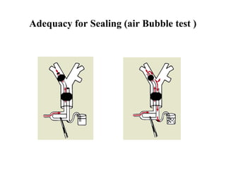 Adequacy for Sealing (air Bubble test )
 