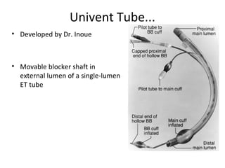 Univent Tube...
• Developed by Dr. Inoue
• Movable blocker shaft in
external lumen of a single-lumen
ET tube
 
