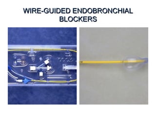WIRE-GUIDED ENDOBRONCHIALWIRE-GUIDED ENDOBRONCHIAL
BLOCKERSBLOCKERS
 